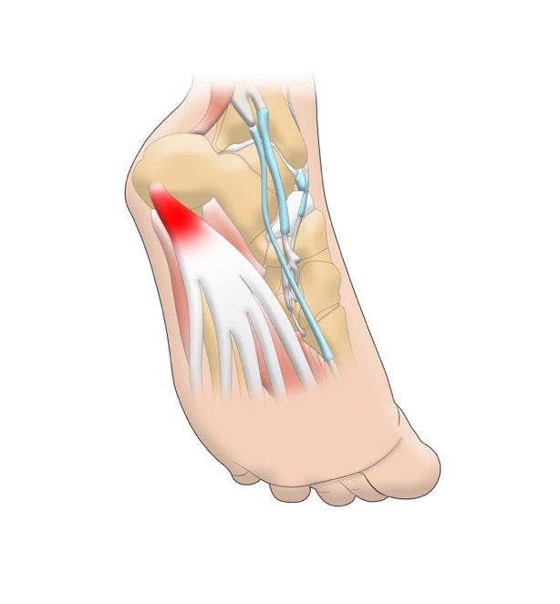 plantar fascia