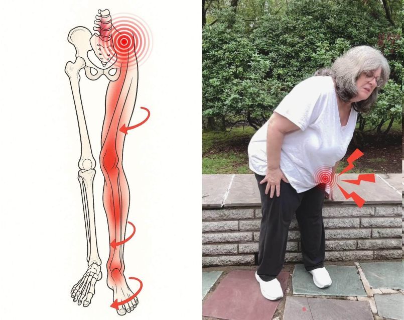 Hip pain illustration and older woman walking
