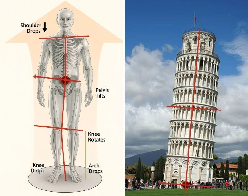 Body alignment illustration and leaning building