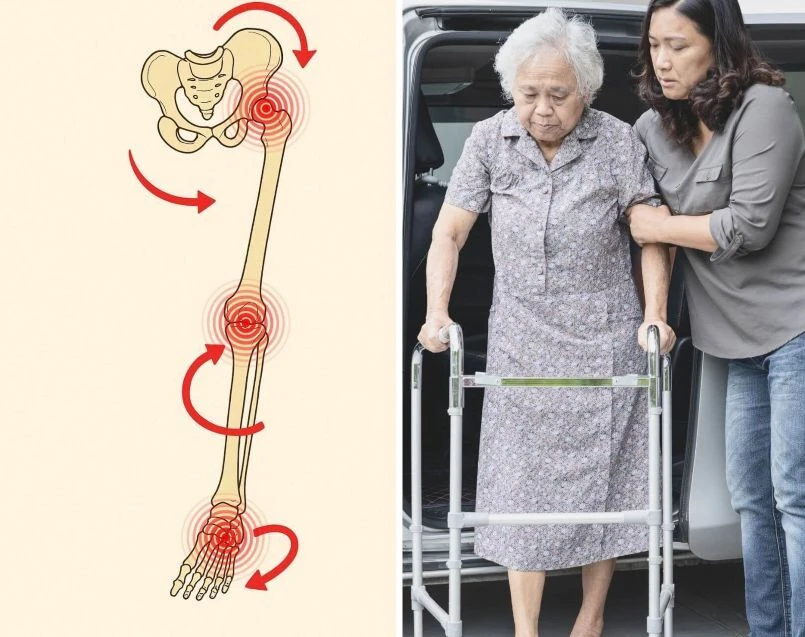 Hip alignment illustration and woman walking with assistance