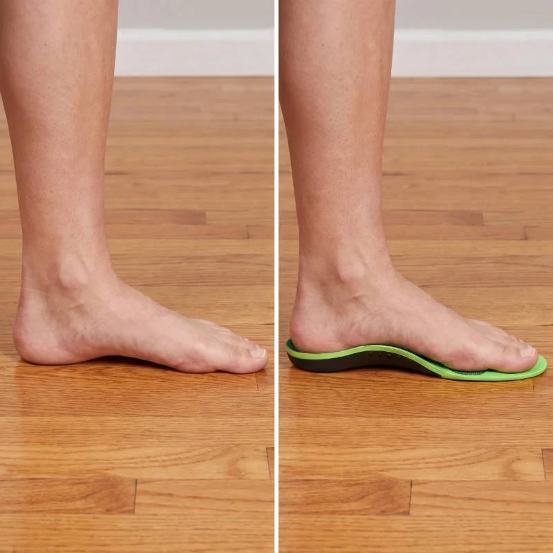 Flat foot without support beside a foot lifted by the XSTANCE arch